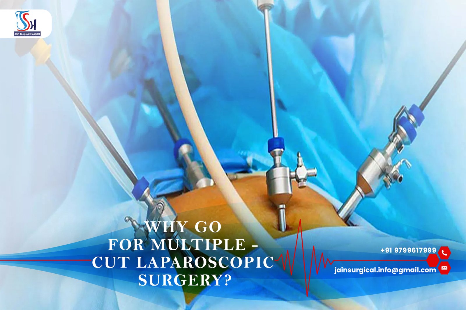 Why go for Multiple – Cut Laparoscopic Surgery?